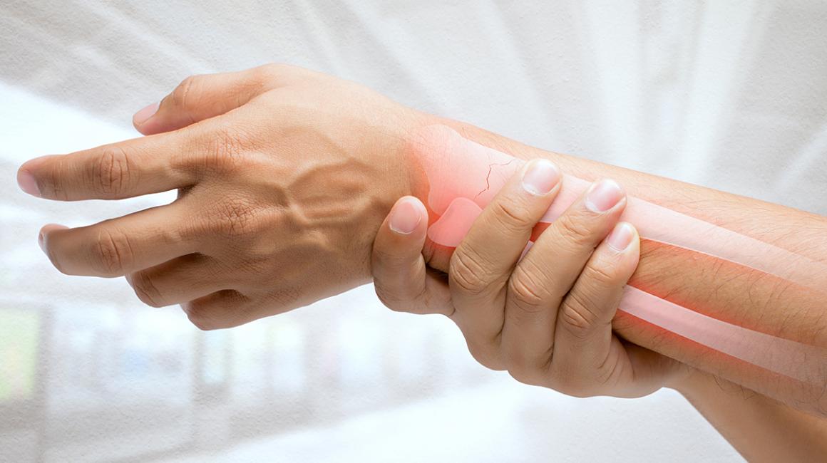 Dłoń w nadgarstku, na przekroju widać złamaną kość