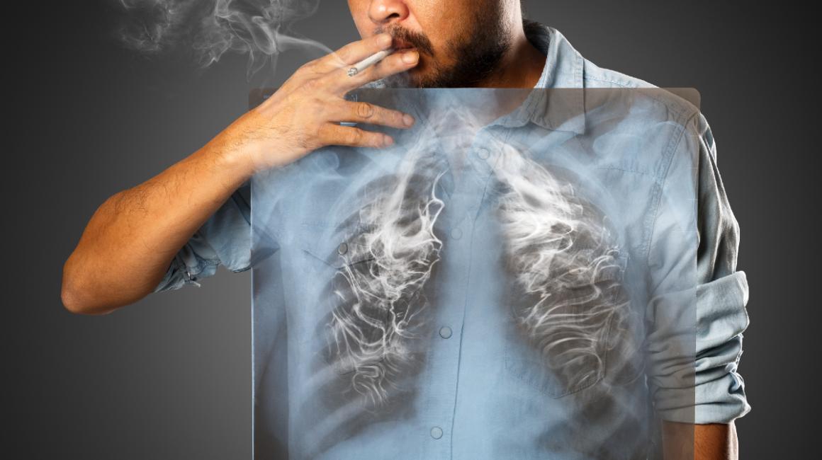Mężczyzna pali papierosa, widzimy jego płuca, a w nich dym