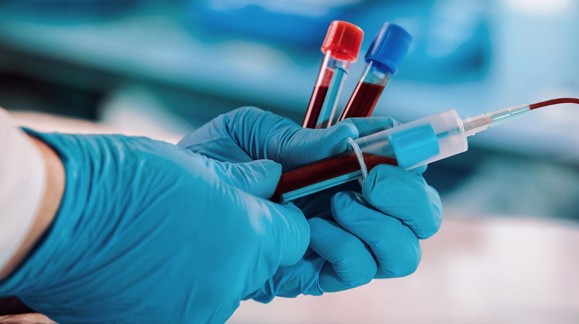 Lekarz pobiera krew do analizy do probówek 