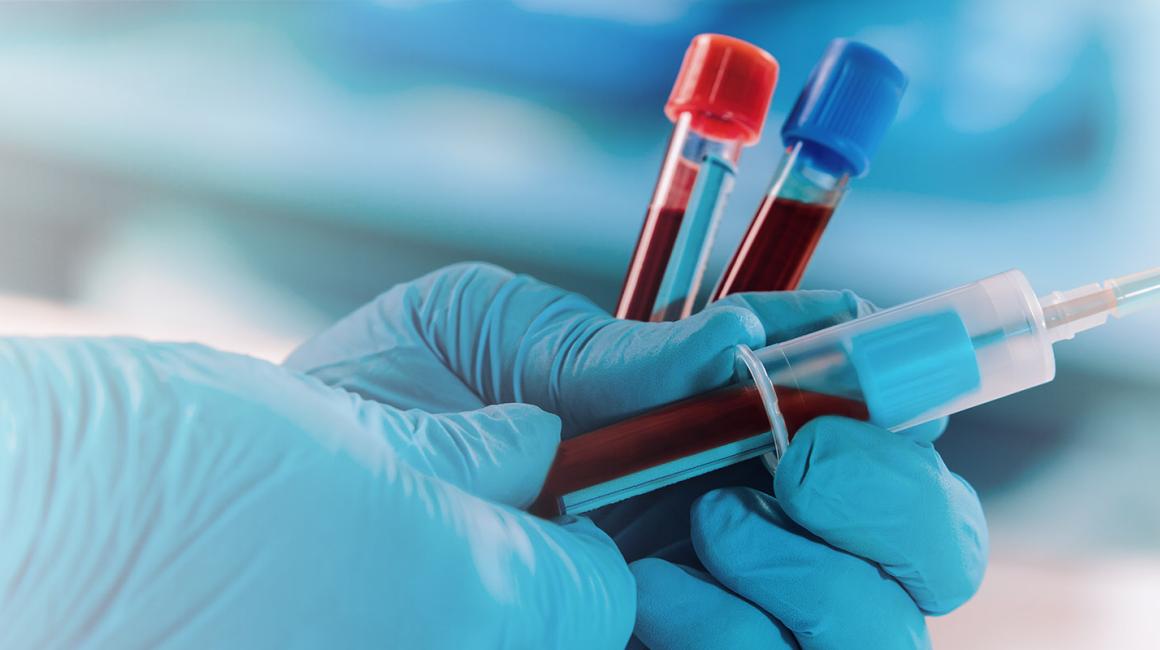 Lekarz pobiera krew do analizy do probówek 