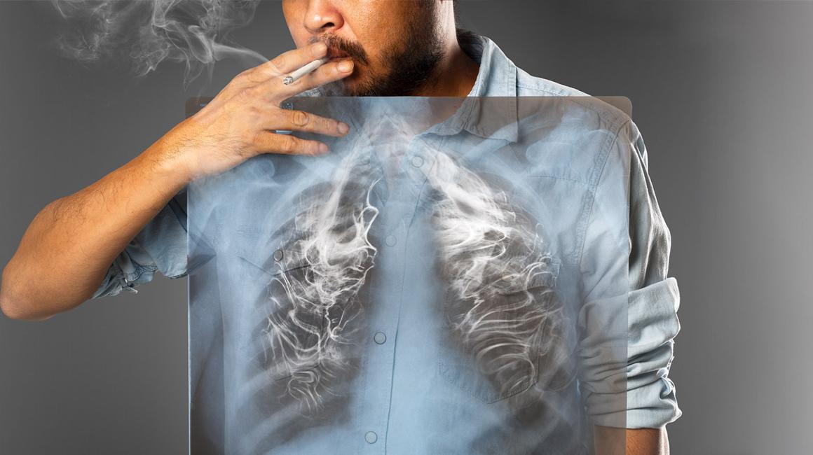 Mężczyzna pali papierosa, widzimy jego płuca, a w nich dym