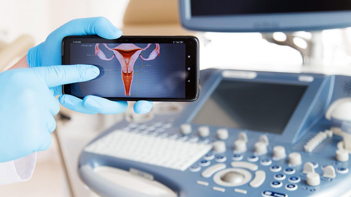 Rysunek macicy wyświetlony na telefonie, w tle aparat do USG