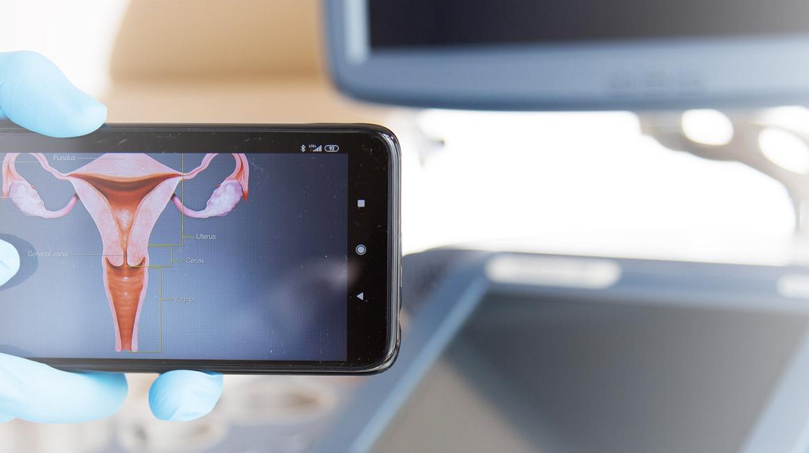 Rysunek macicy wyświetlony na telefonie, w tle aparat do USG