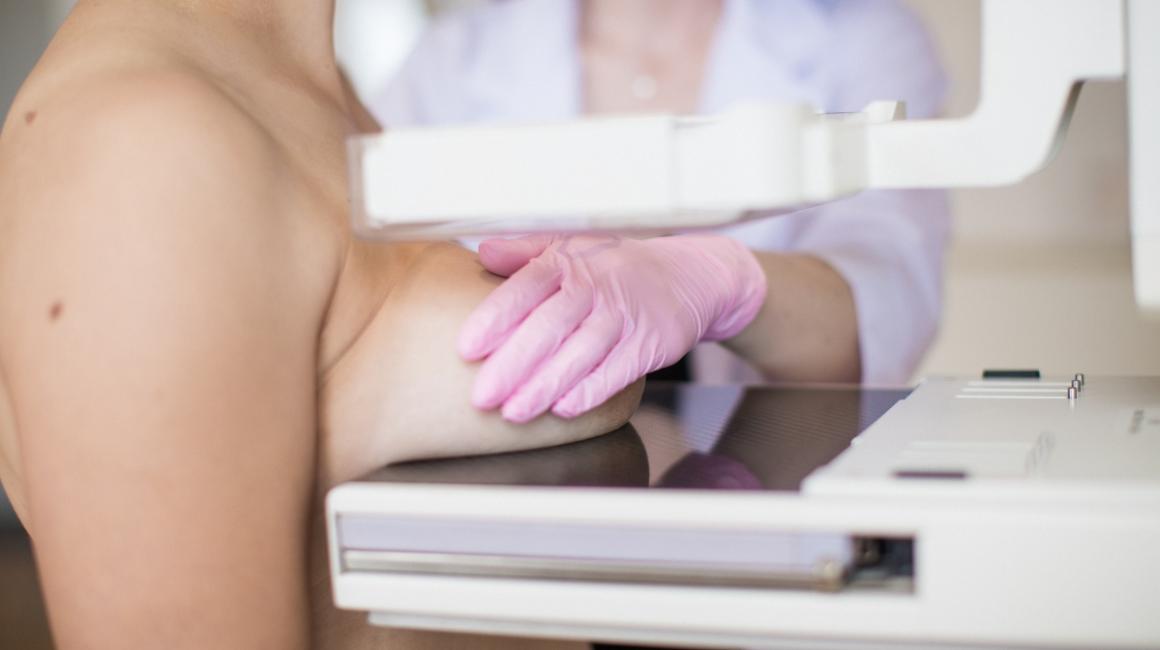 Kobieta podczas mammografii. Pielęgniarka układa pierś zasłaniając sutek.