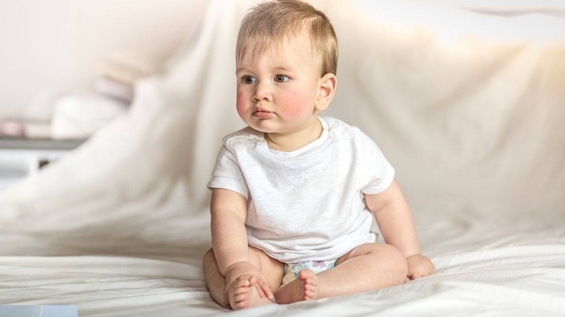 niemowlak z atopowym zapeleniem skóry