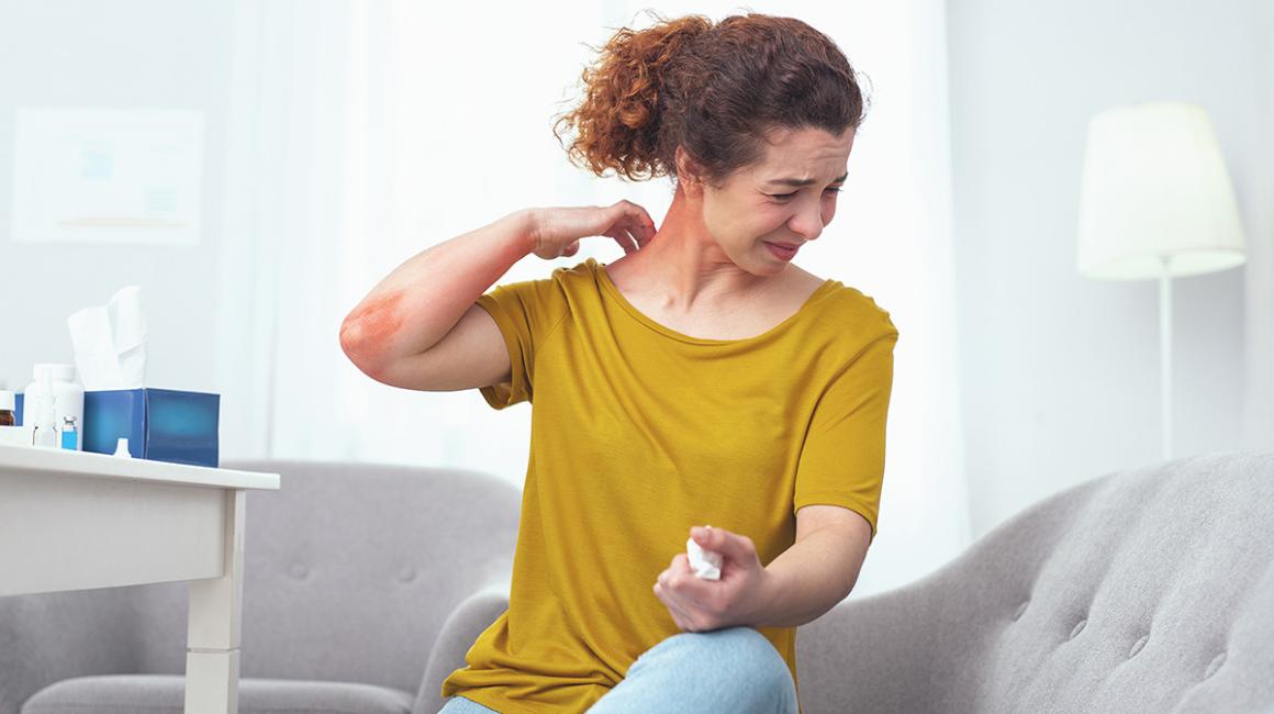 Kobieta drapie czrwone miejsce na szyi