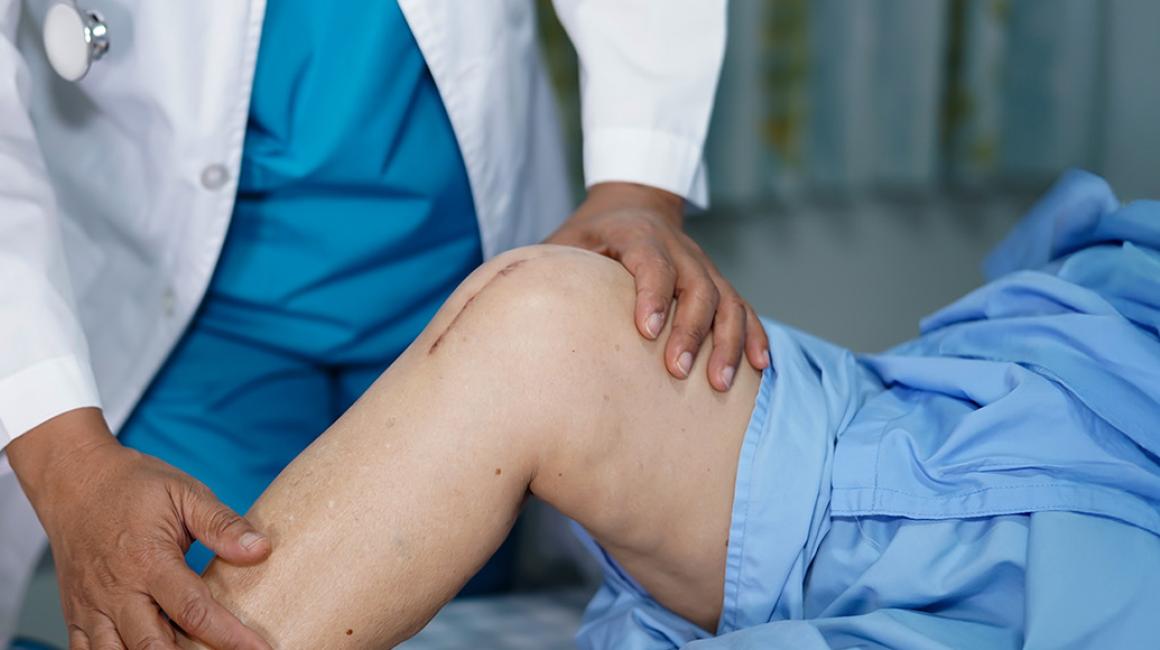 lekarz ogląda kolano pacjenta z blizną