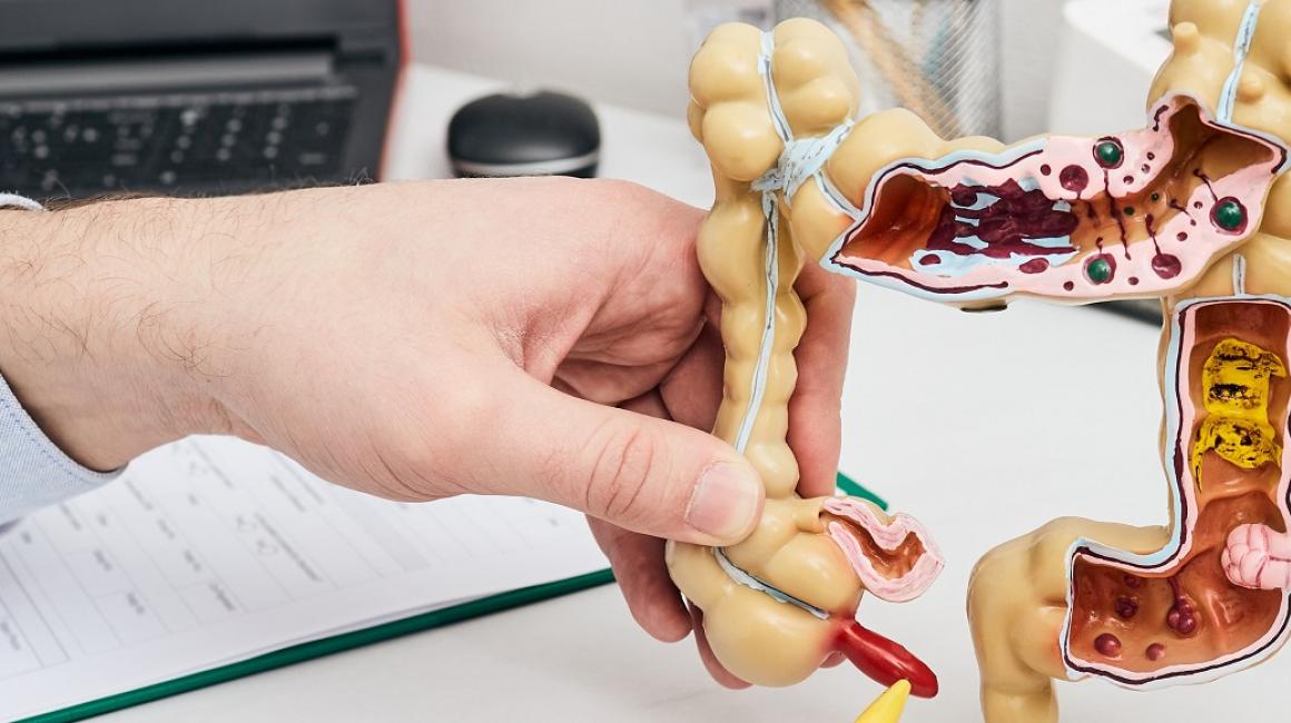 Model jelita grubego w rękach lekarza