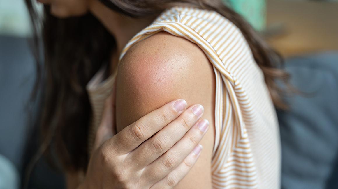 ramię kobiety po szczepieniu