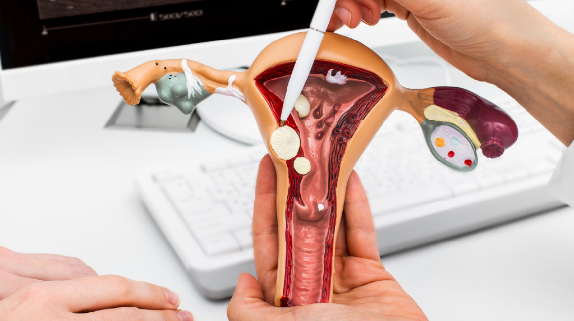 lekarz okazuje model szyjki macicy