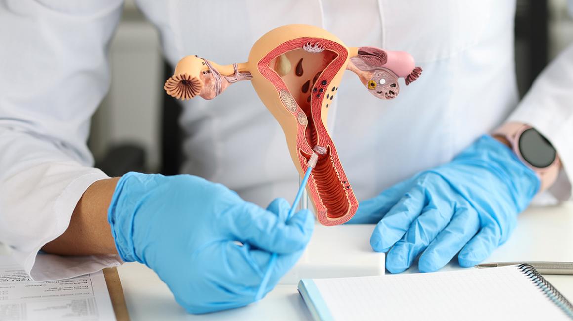 lekarz pokazuje model macicy