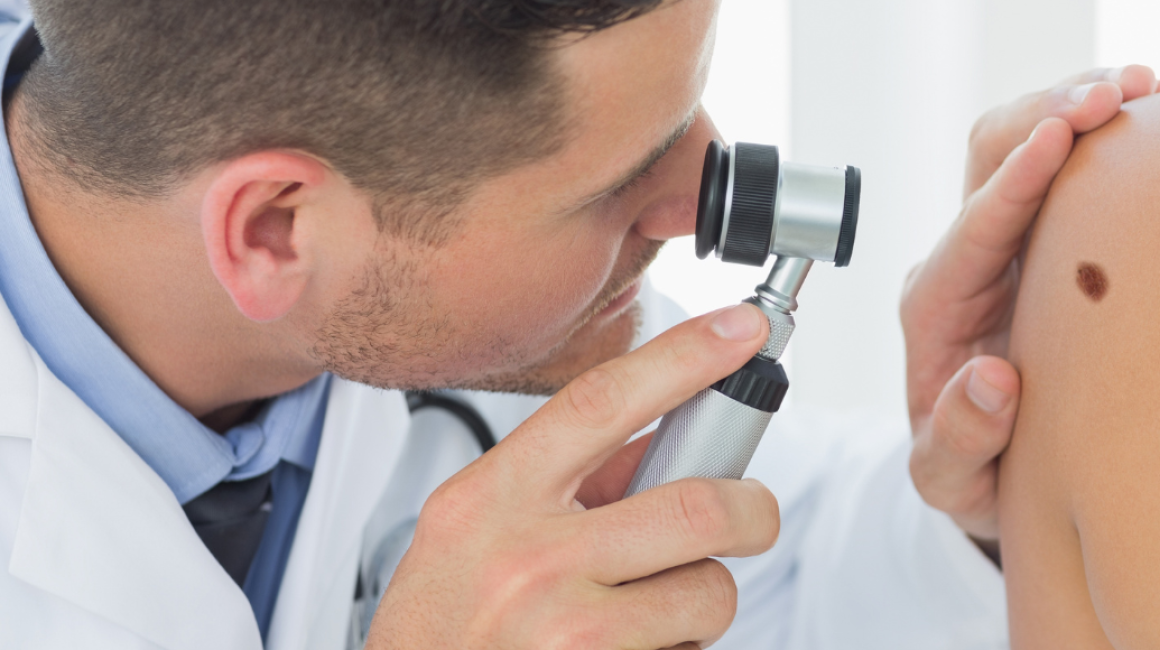 lekarz bada dermatoskopem