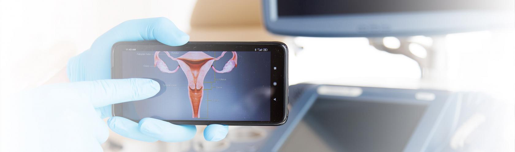 Rysunek macicy wyświetlony na telefonie, w tle aparat do USG