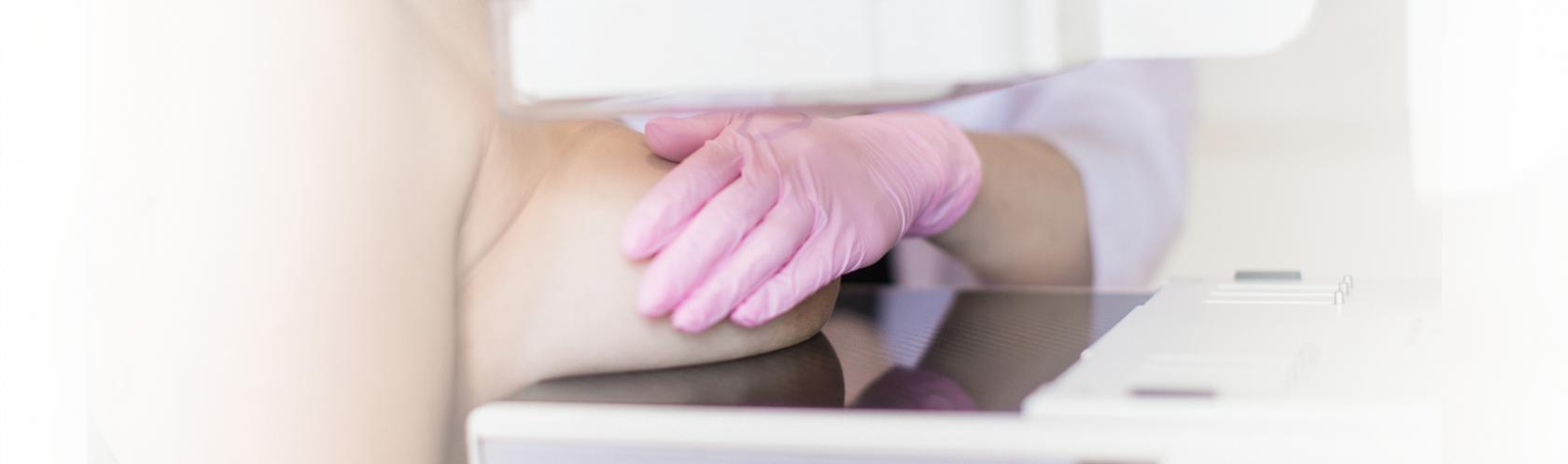 Kobieta podczas mammografii. Pielęgniarka układa pierś zasłaniając sutek.