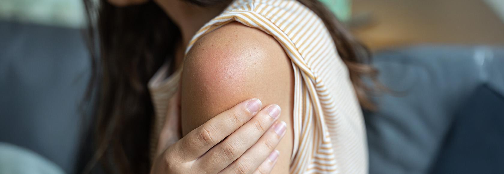 ramię kobiety po szczepieniu