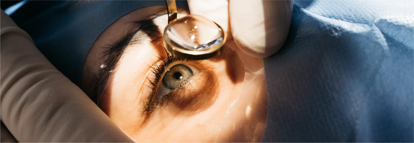 jakieś narzędzie trzymane nad okiem, ręce lekarz w rękawiczkach