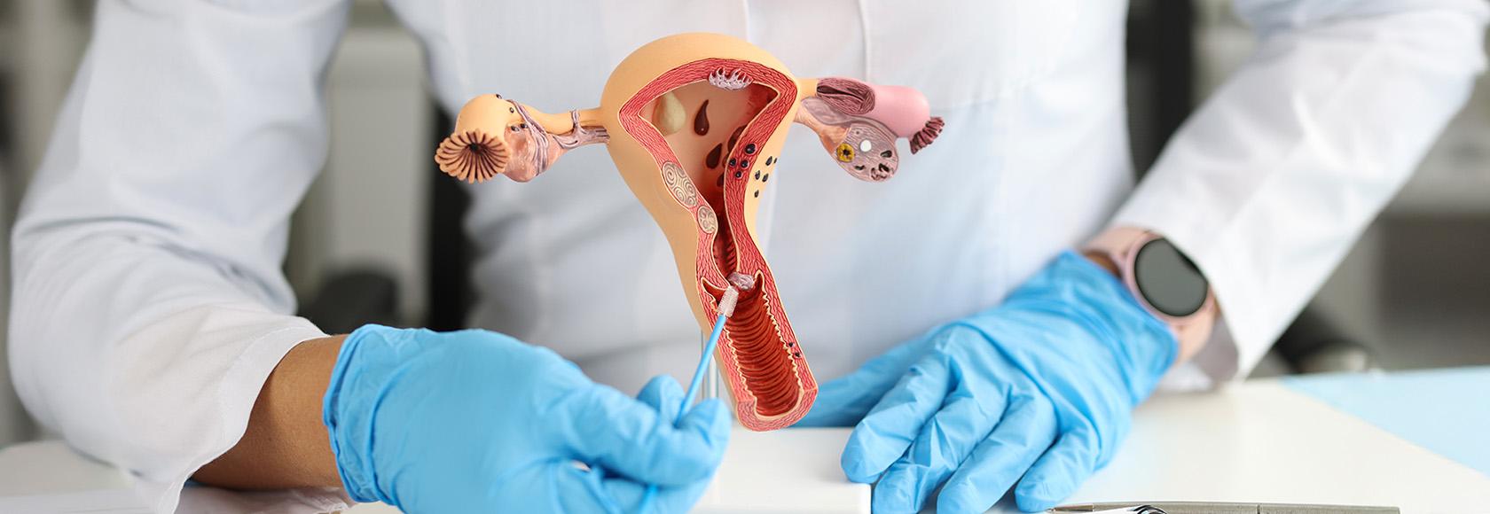 lekarz pokazuje model macicy