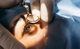jakieś narzędzie trzymane nad okiem, ręce lekarz w rękawiczkach