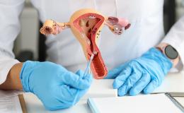 lekarz pokazuje model macicy