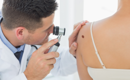 Lekarz bada dermatoskopem