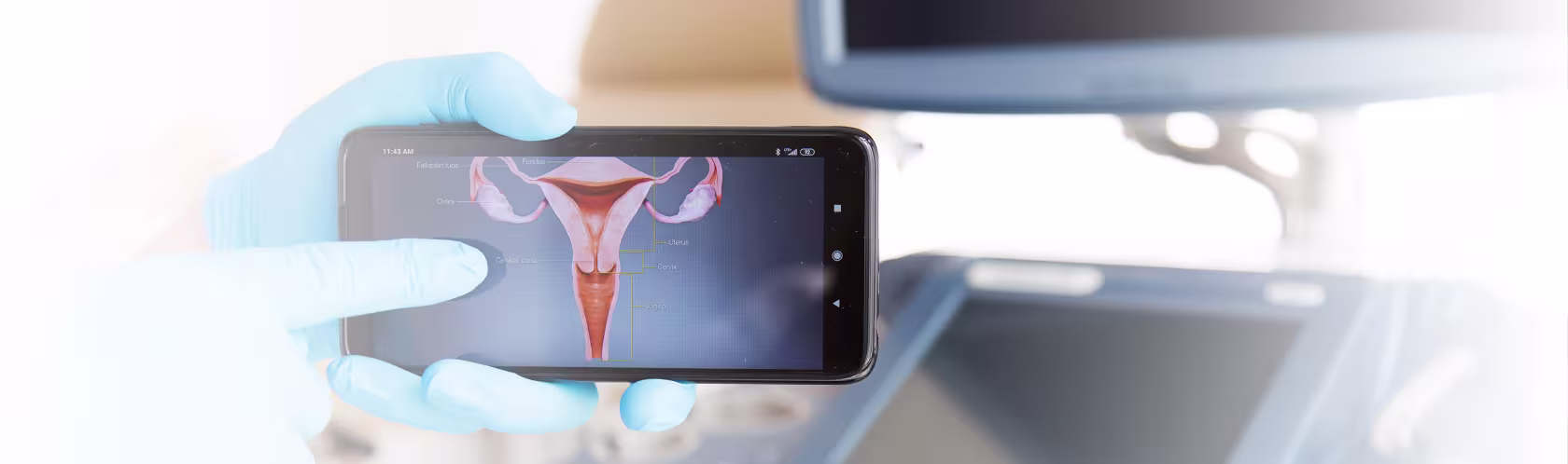Rysunek macicy wyświetlony na telefonie, w tle aparat do USG