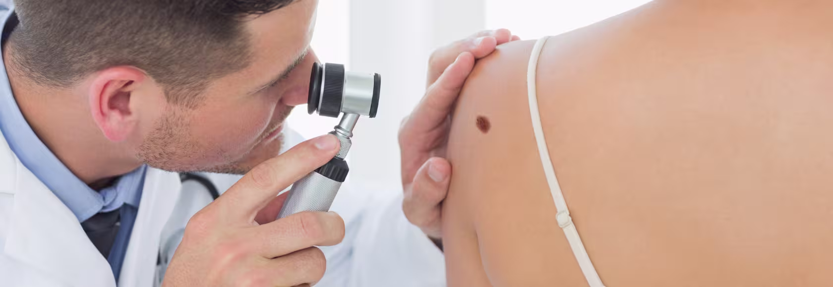lekarz bada dermatoskopem
